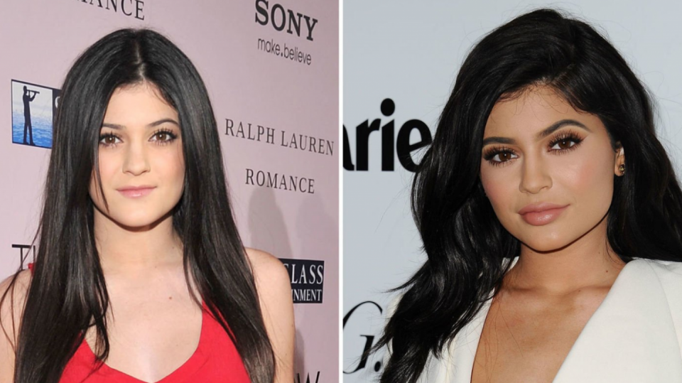 Proměny nejmladší Kardashianky